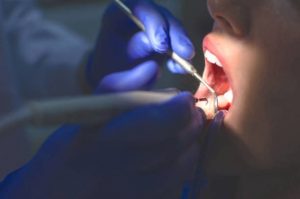 dentist Adelaide